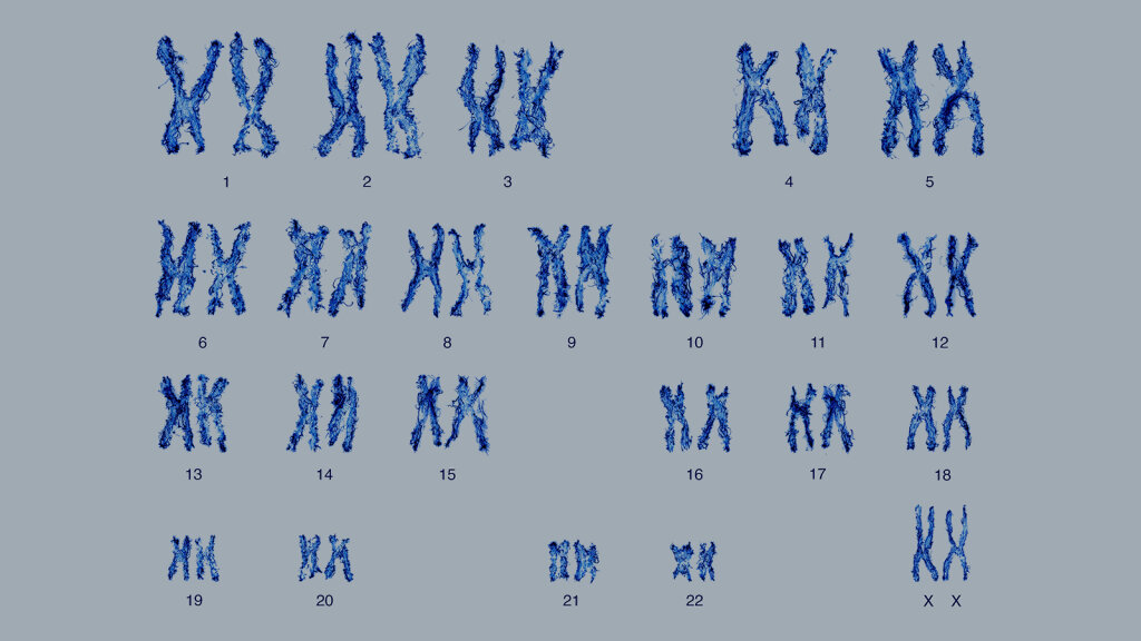 Wie viele Chromosomen hat ein Mensch?