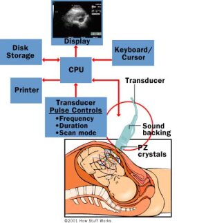 ultrasound-parts.jpg