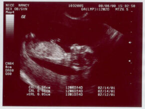 ultrasound-nice-picture1a.jpg