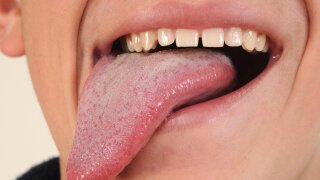 Crazy Common Things People Swallow (That They Shouldn’t) | HowStuffWorks