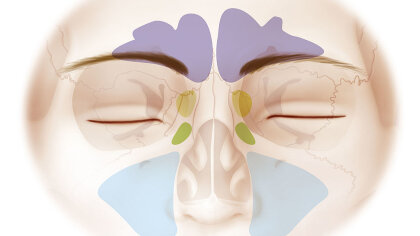 Cavity Anatomy - Understanding Sinus Congestion | HowStuffWorks