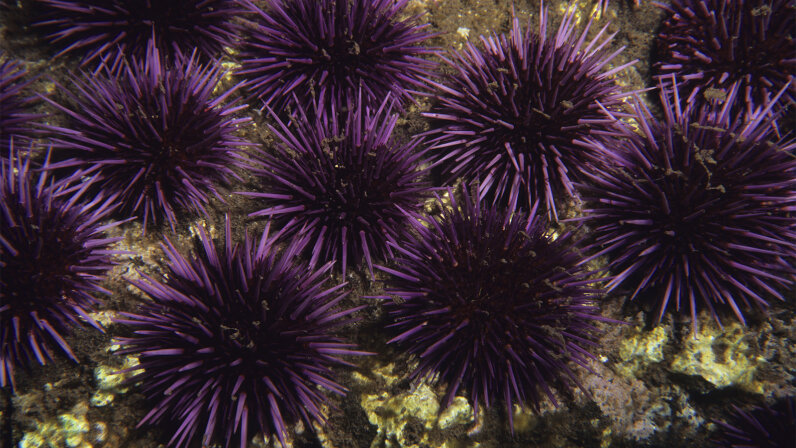water shoes sea urchins