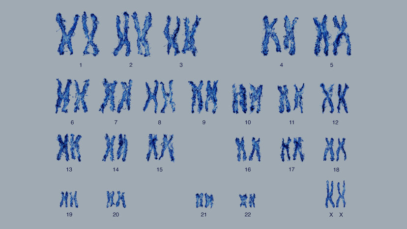 диаграмма хромосом