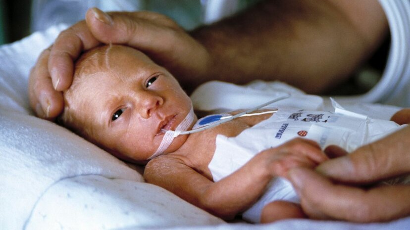 Do Premature Babies Have Delayed Development?