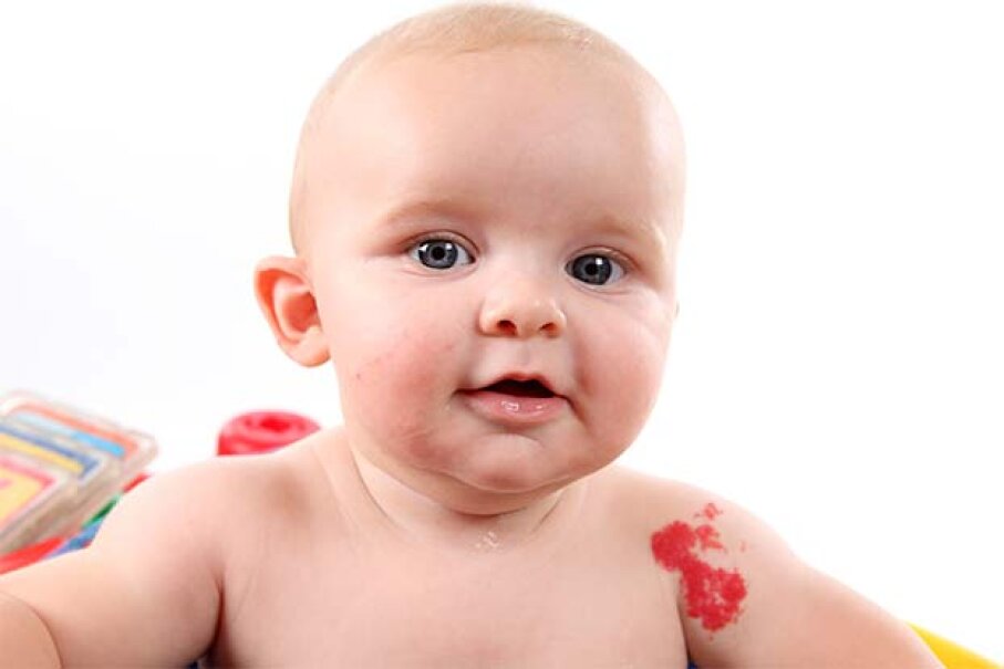 3-diet-and-birthmarks-diet-and-birthmarks-10-pregnancy