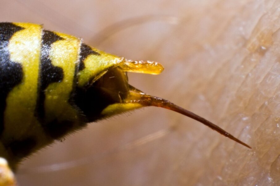 4 Bee Wasp Or Yellow Jacket Sting 10 Reasons Not To Go To The Er Howstuffworks